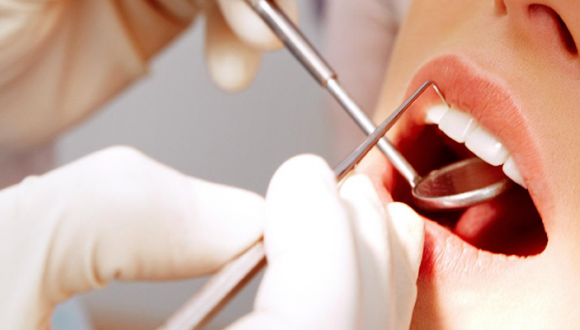 Gingivitis